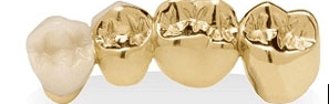 Sell Dental Gold Chicago